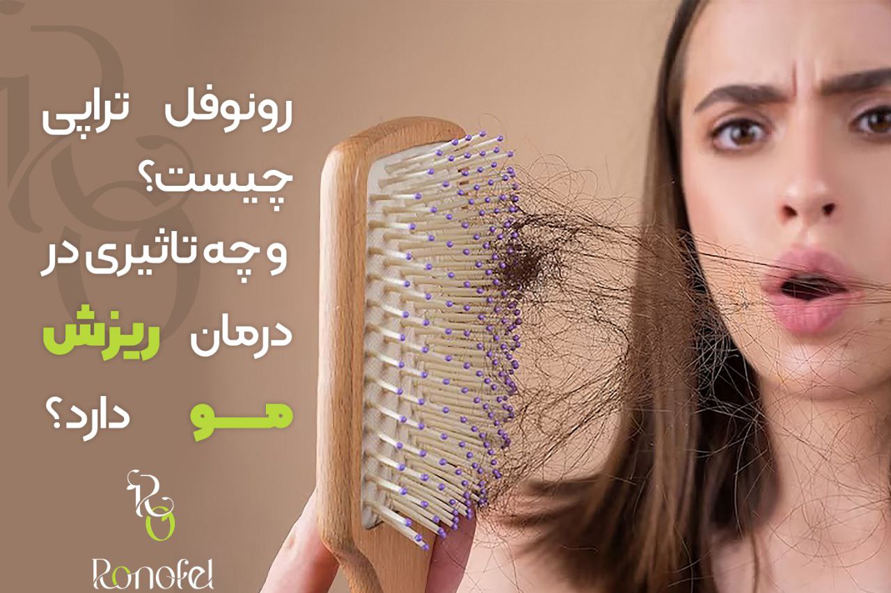 رونوفل تراپی چیست و چه تاثیری در درمان ریزش مو دارد؟
