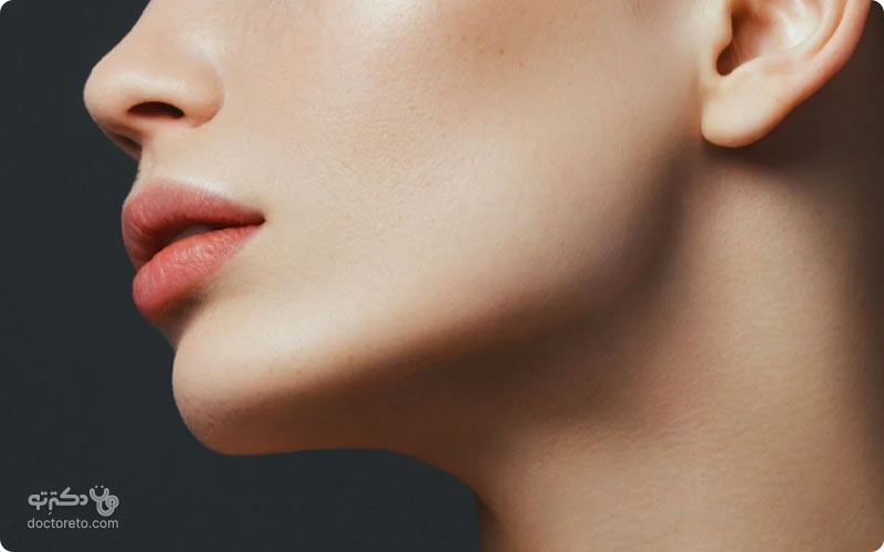 جراحی زاویه سازی فک دائمی است و نیازی به ترمیم ندارد.