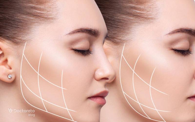 مزایای بوکال فت غبغب کاهش چربی این ناحیه است.