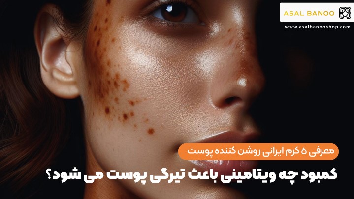 کمبود چه ویتامینی باعث تیرگی پوست می شود؟