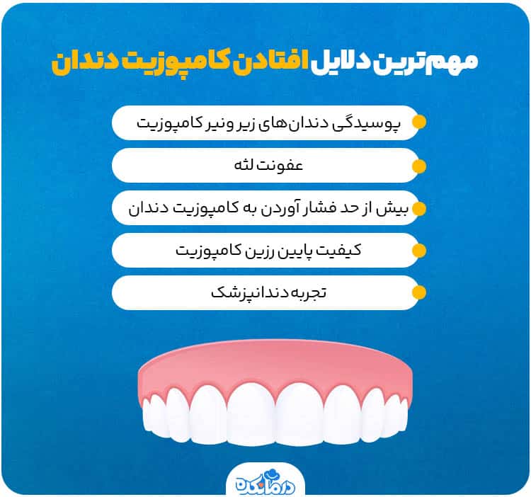 اینفوگرافیک علت افتادن کامپوزیت دندان 