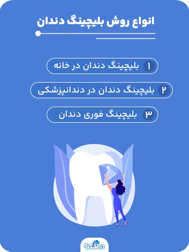 اینفوگرافیک انواع روش بلیچینگ دندان 