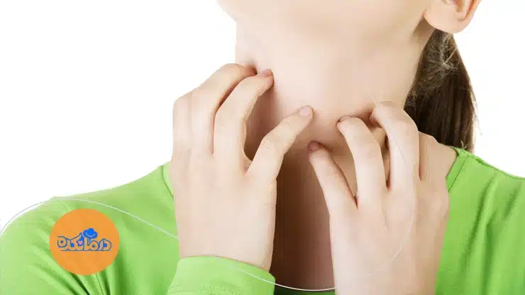 پیشگیری از خارش گلو