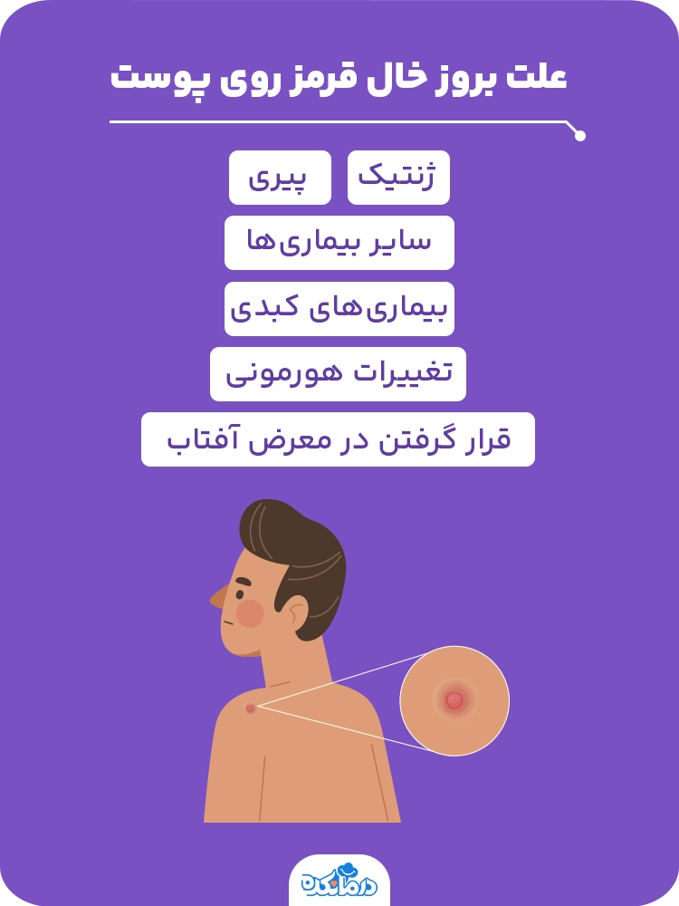 اینفوگرافیک علت بروز خال قرمز روی پوست