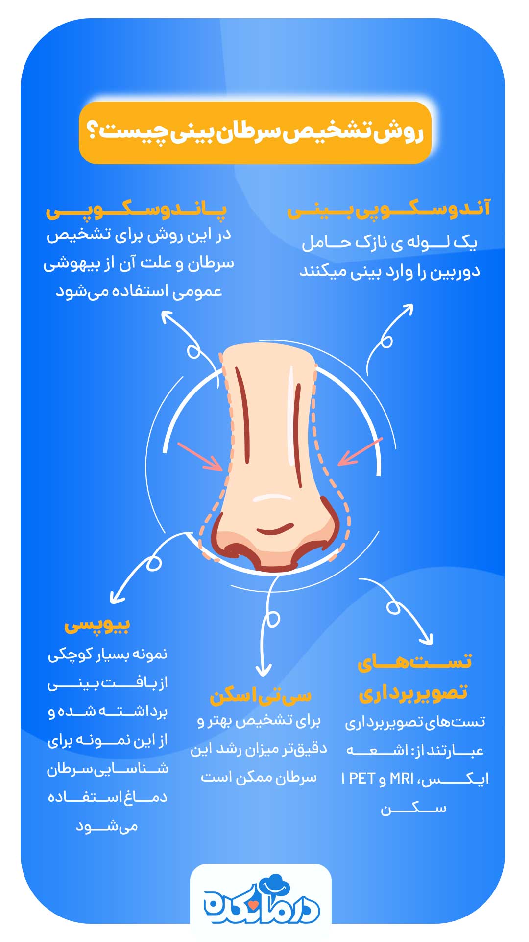 اینفوگرافی از انواع روش‌های تشخیصی سرطان بینی