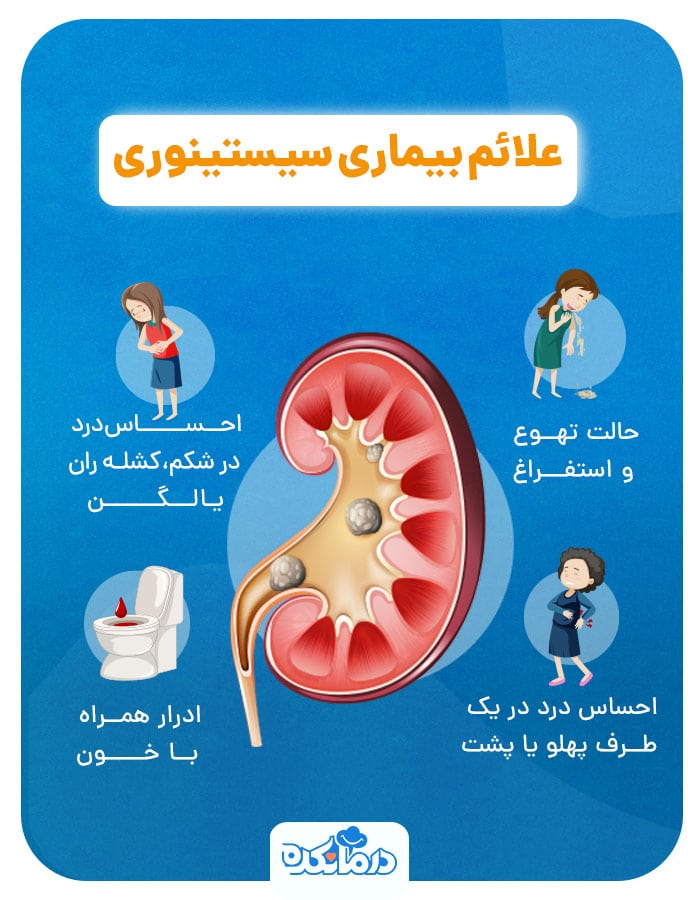 اینفوگرافی از علائم بیماری سیستینوری
