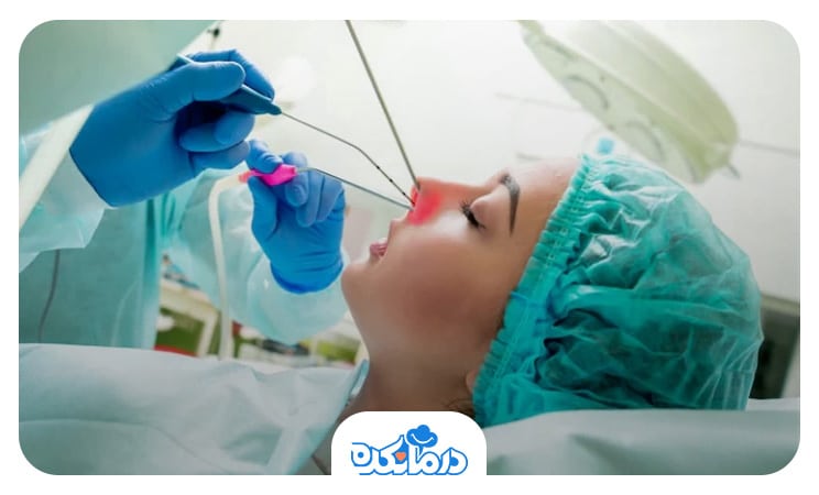  جراحی باز بینی را می‌بینید.