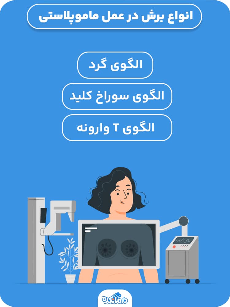 اینفوگرافیک انواع برش در عمل ماموپلاستی 