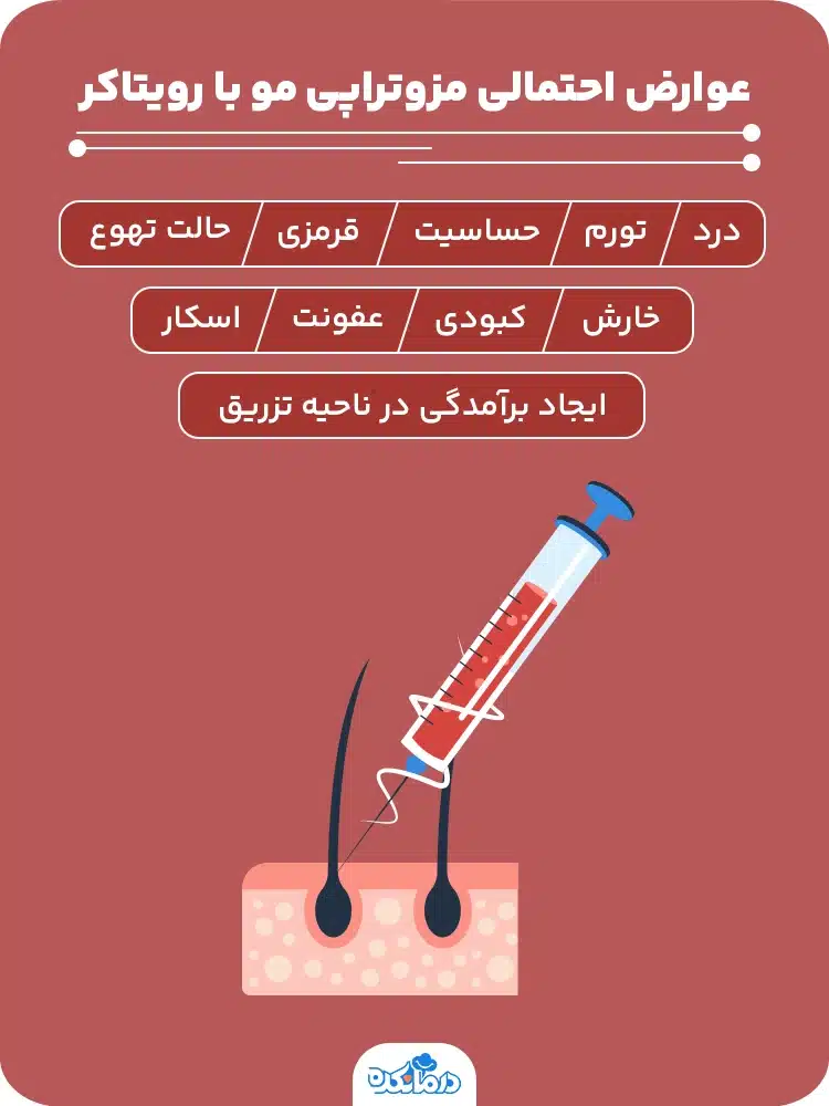 آلترنیتیو: اینفوگرافیک عوارض احتمالی مزوتراپی مو با رویتاکر (Revitacare)