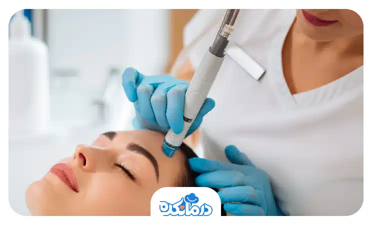  تصویر پزشکی که در حال میکرونیدلینگ صورت یک مراجعه‌کننده است.
