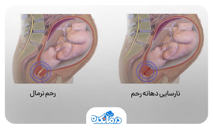  تصویری از جنین در رحم مادر